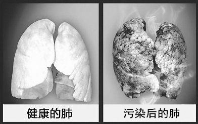 被雾霾感染的肺 被雾霾感染的肺